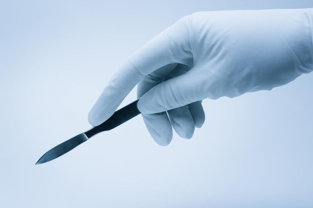 pisau bedah untuk pembedahan pembesaran zakar